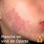 Mancha en vino de Porto